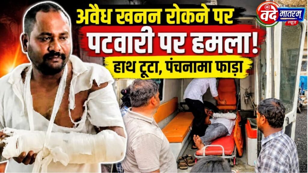 Ratlam : पटवारी का हाथ तोड़ा और पंचनामा फाड़ बदमाश फरार 1 Patwari's arm broken in Ratlam